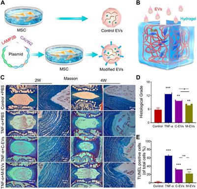 Application of mesenchymal stem cell-derived exosomes from different sources in intervertebral disc degeneration